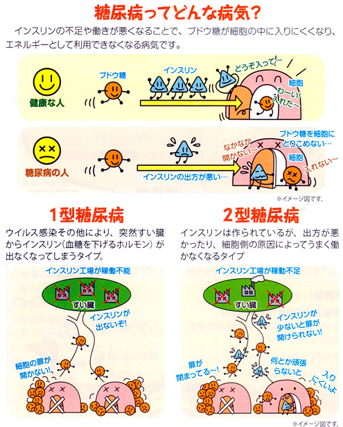 糖尿病の説明